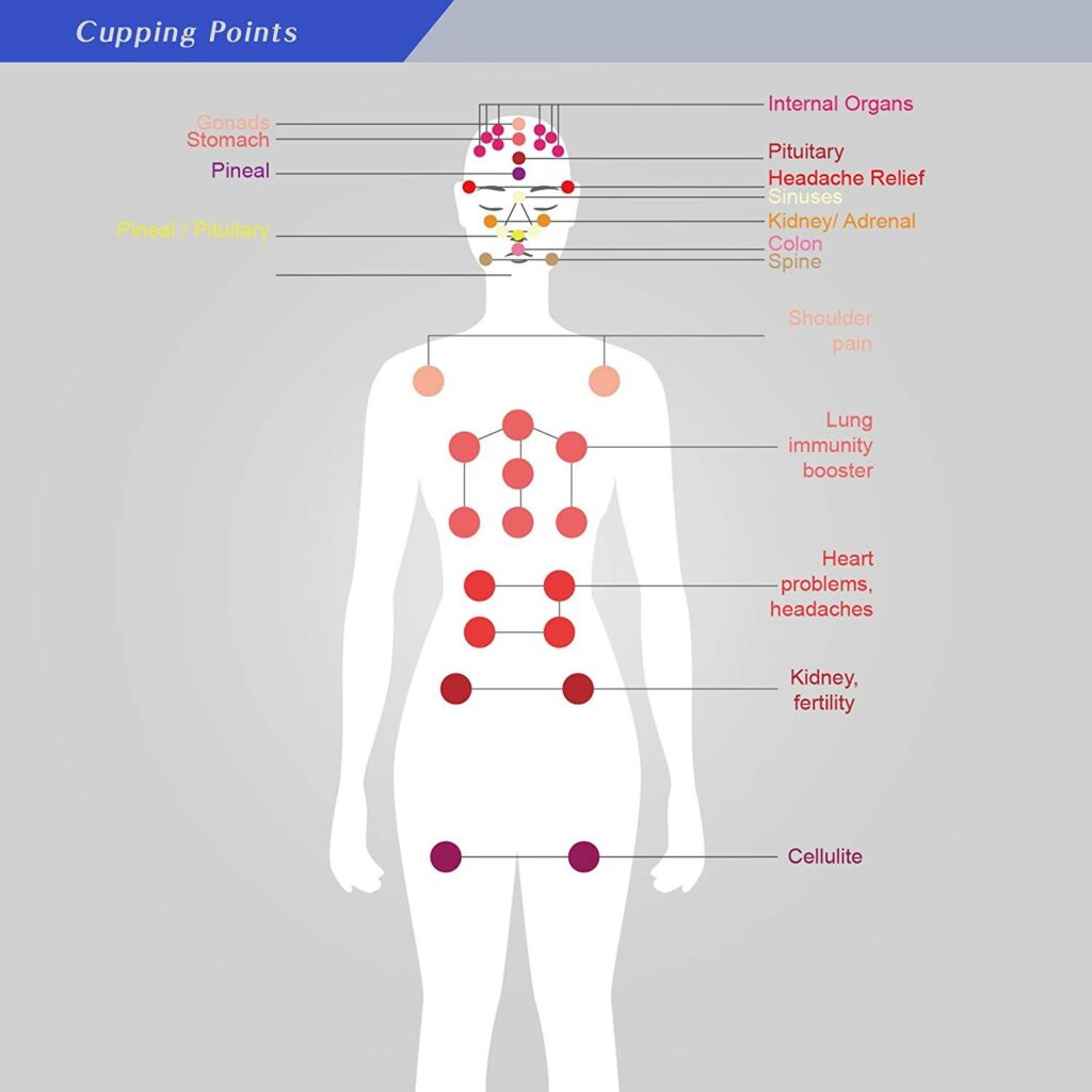 Map of Dry Cupping Areas in teh body according to objectives of treatment